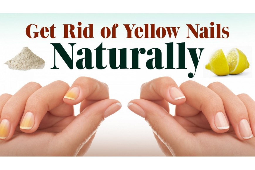 Whiten Yellow Nails – Remove Nail Polish Stains |Tips to Get rid of Yellow Nails