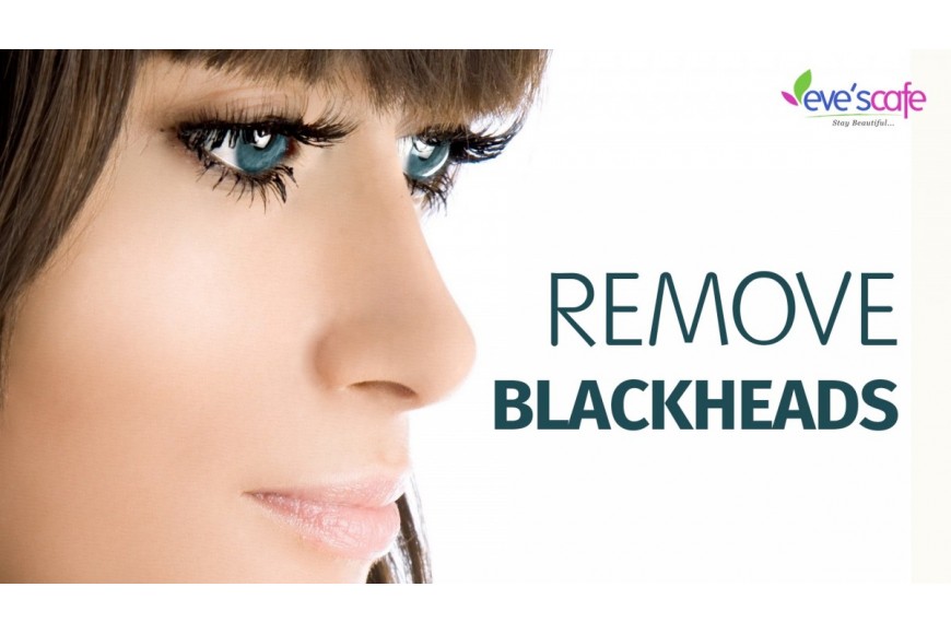 Remove Blackheads at Home – DIY