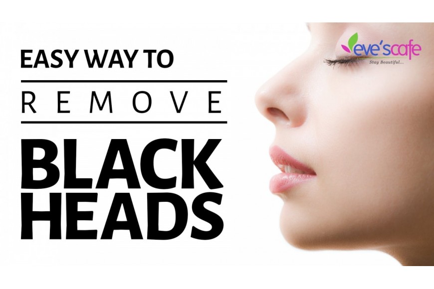 Remove Blackheads and Whiteheads at Home